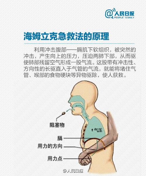 小学生急救常识